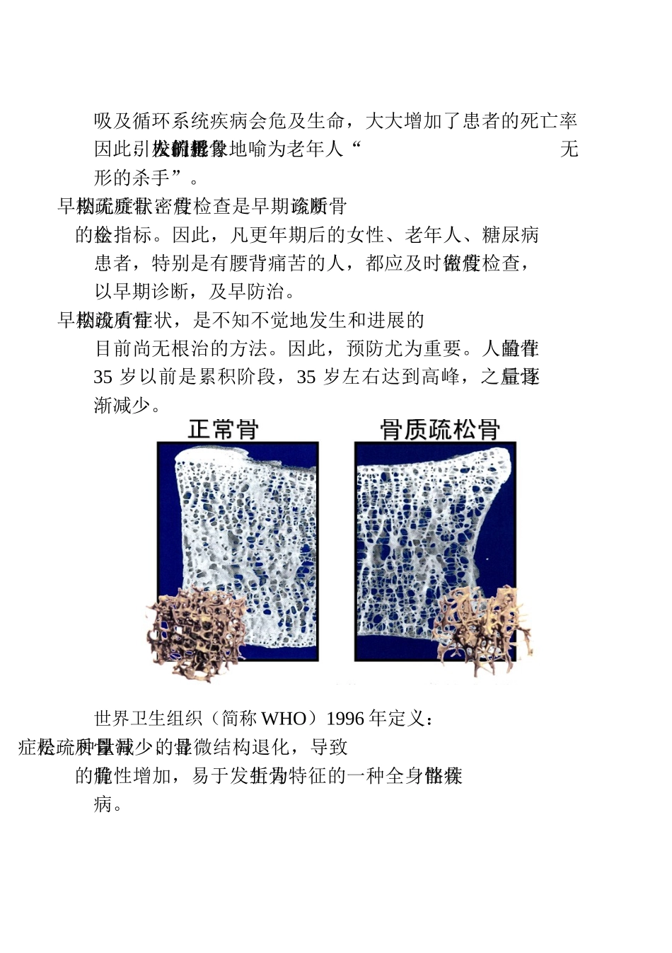 骨质疏松宣传册子_第3页