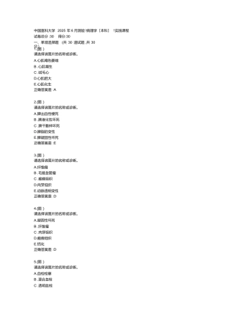 中国医科大学2025年春学期《病理学》实践考试试题答卷2