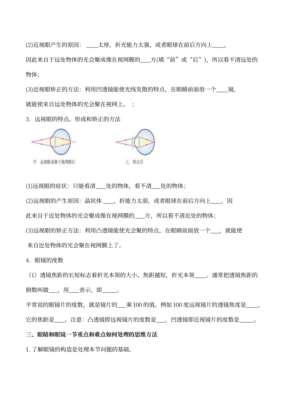 人教版物理八年级上册眼睛和眼镜_第2页
