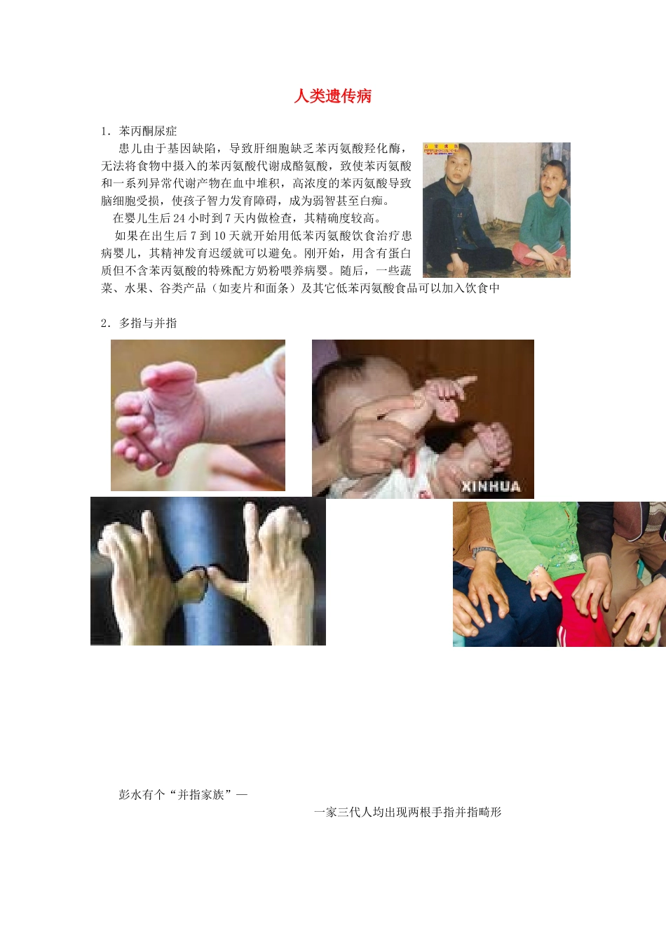 高二生物 4.5《人类遗传病》相关素材（苏教版必修2）_第1页