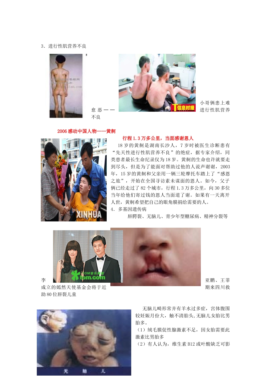 高二生物 4.5《人类遗传病》相关素材（苏教版必修2）_第2页