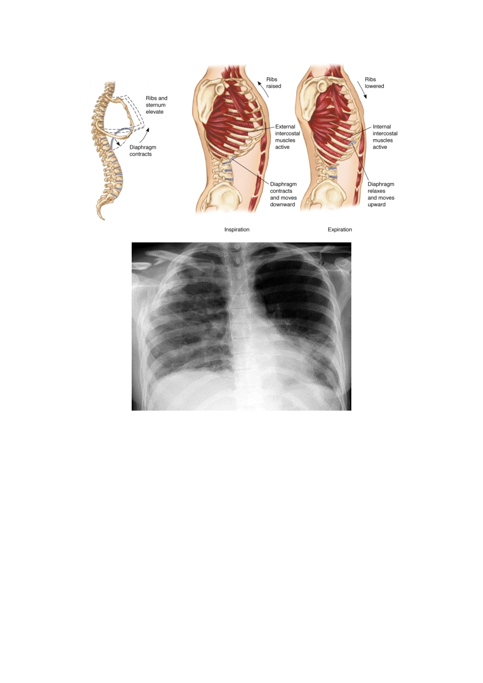 第二十六单元---胸部损伤_第3页