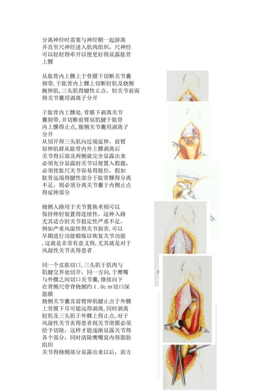 人工肘关节置换手术步骤_第2页