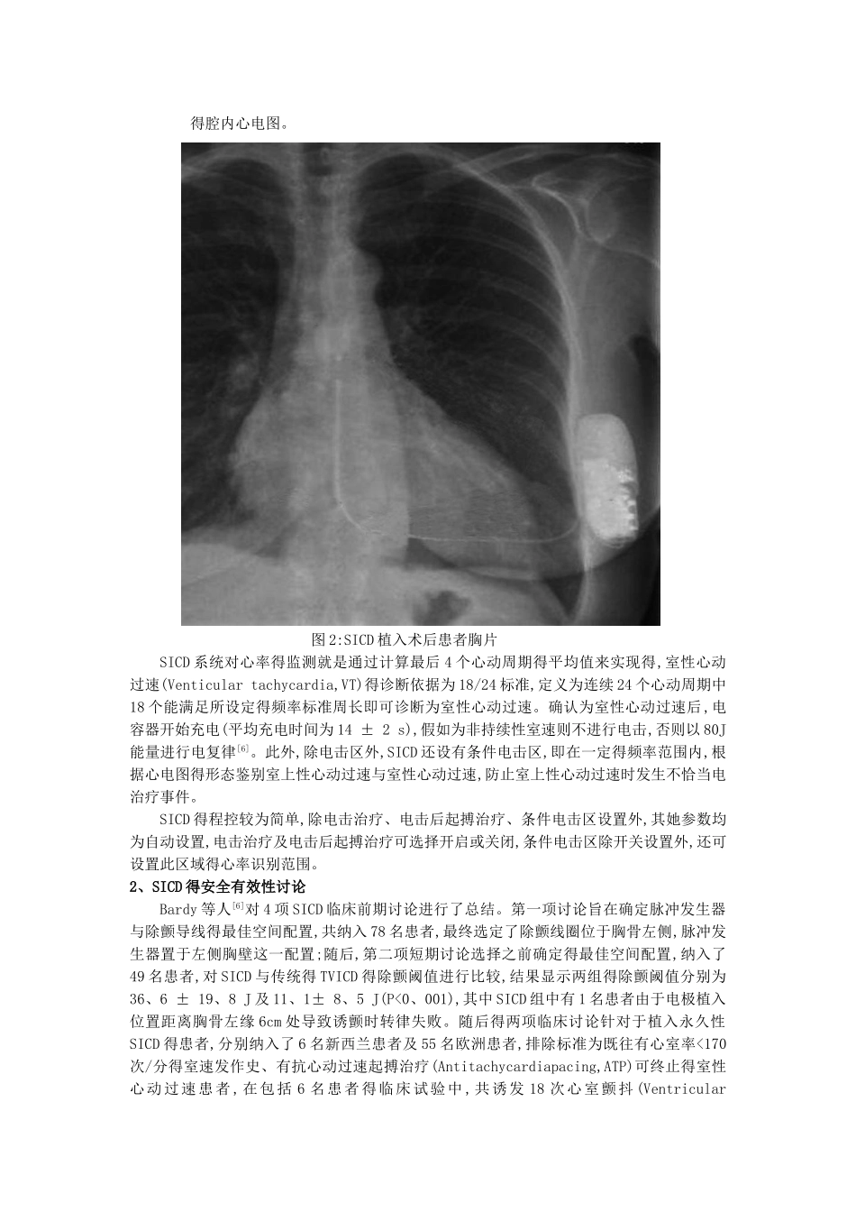 全皮下埋藏式心脏转复除颤器_第3页