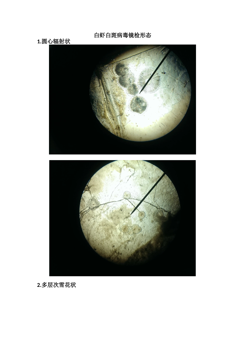 南美白对虾白斑镜检图_第1页