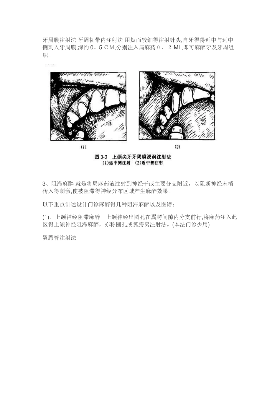 口腔颌面外科门诊系列讲座—麻醉篇_第2页