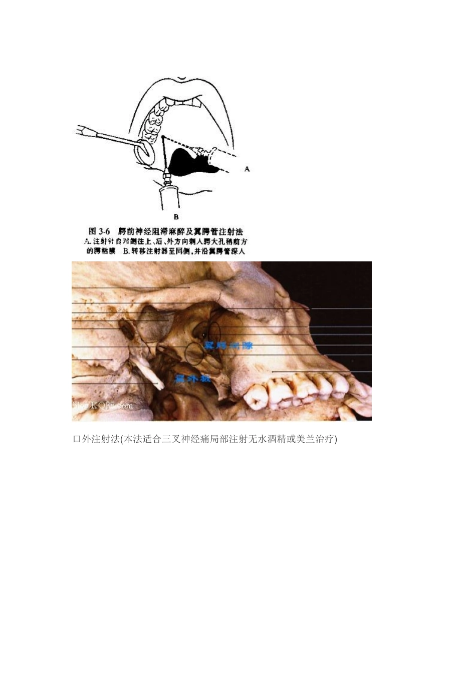 口腔颌面外科门诊系列讲座—麻醉篇_第3页