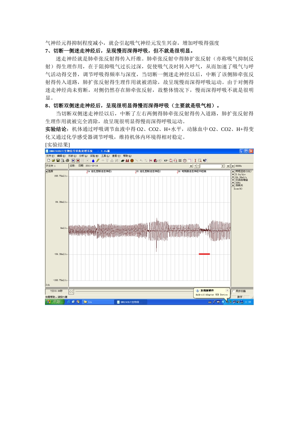 呼吸运动调节实验报告_第3页