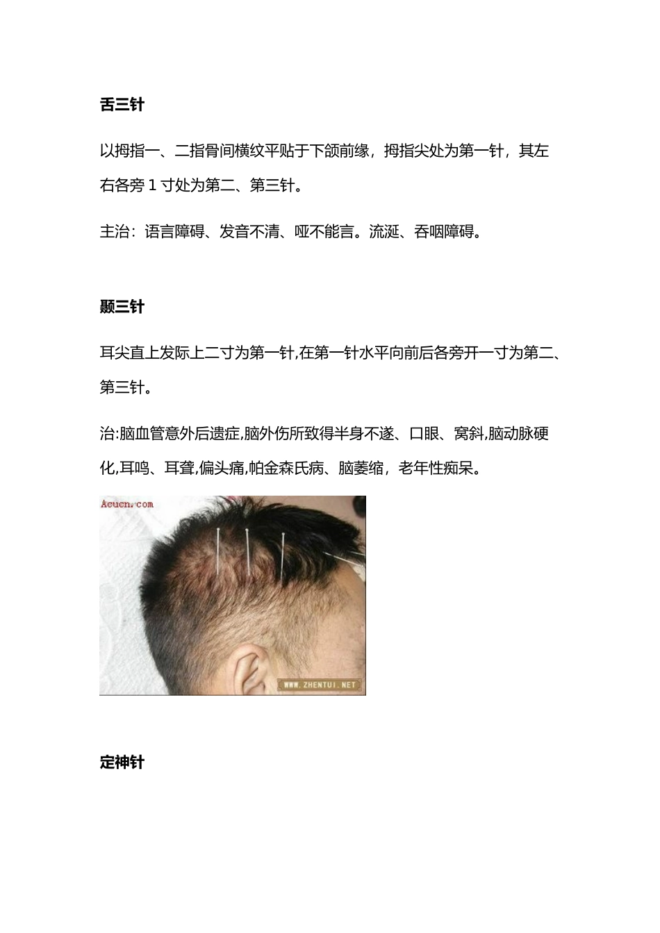 图文全解靳三针_第3页