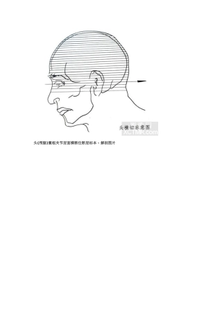 头颅横切面断层解剖