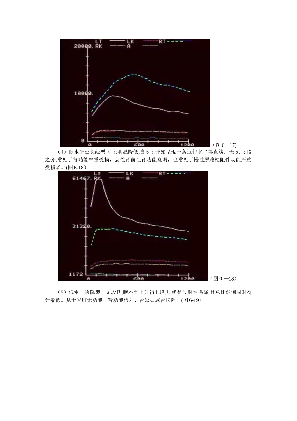 异常肾图类型及临床意义_第2页