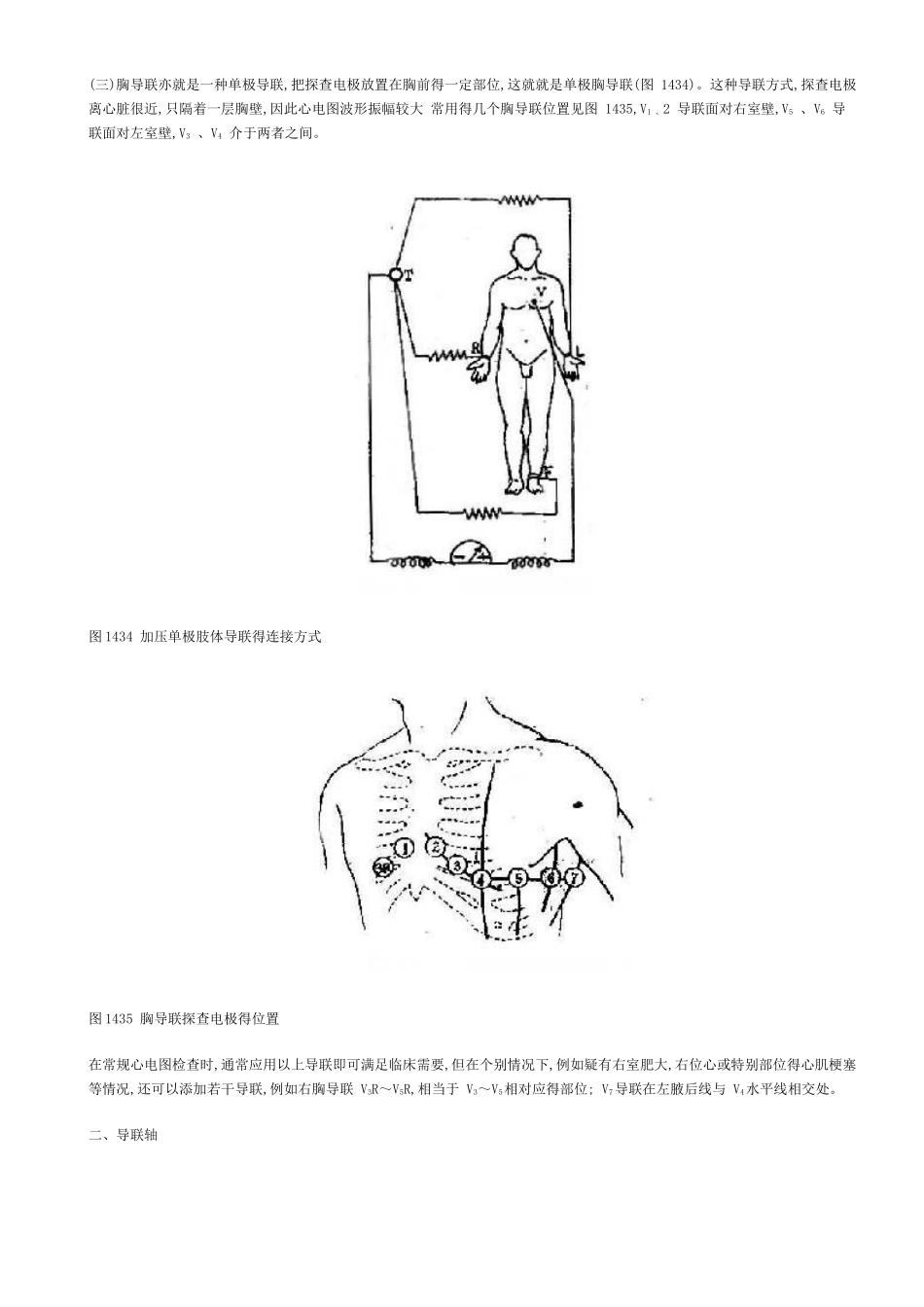 心电图导联及心电轴_第3页