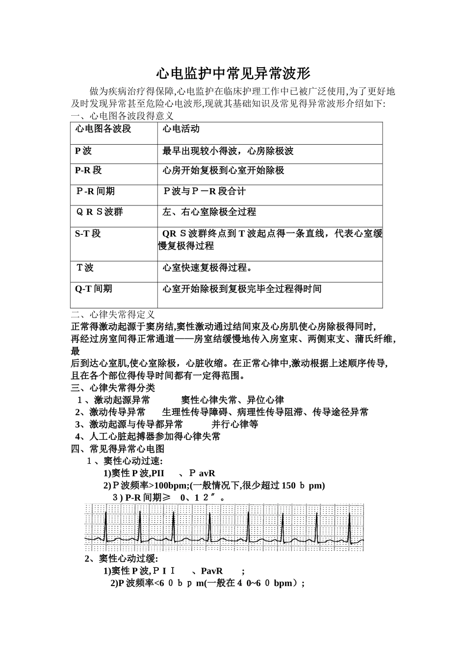 心电监护中常见的异常波形_第1页