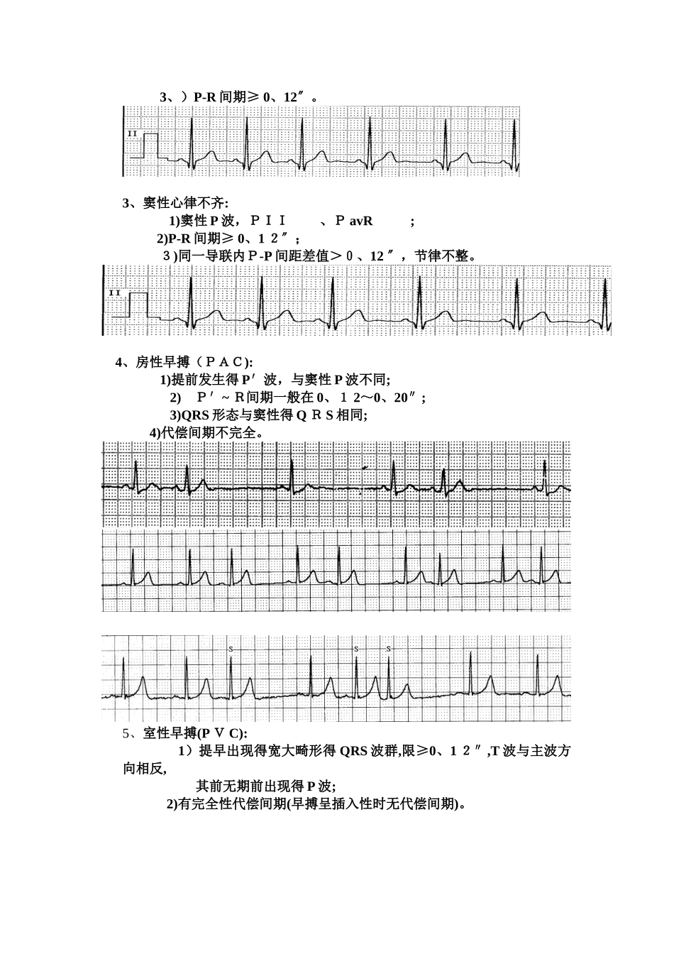 心电监护中常见的异常波形_第2页