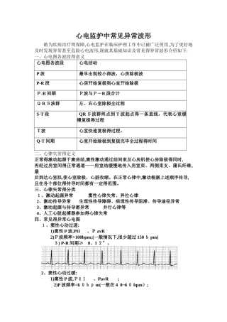心电监护中常见的异常波形