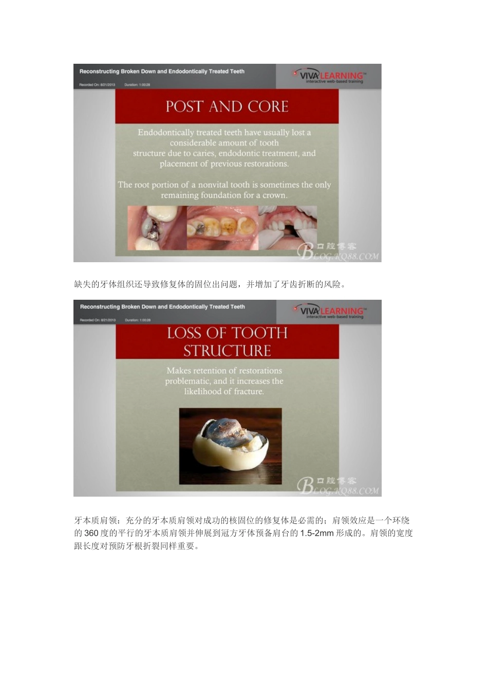 根管治疗后冠部修复_第3页