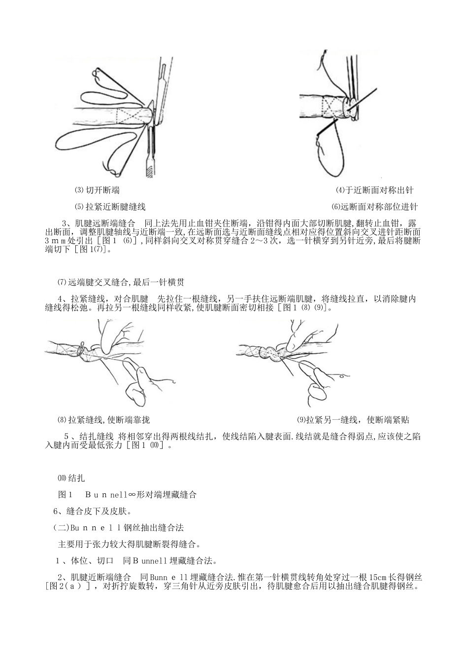 肌腱缝合方法_第2页