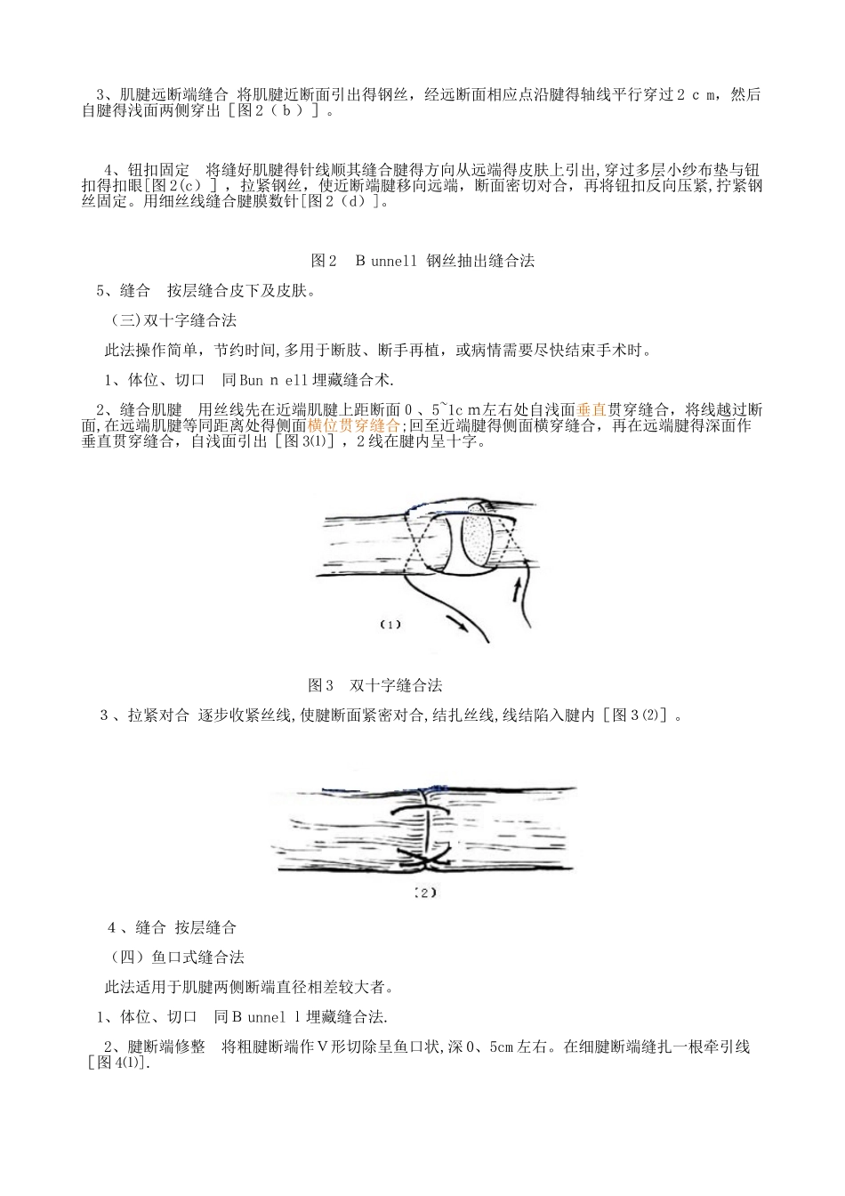 肌腱缝合方法_第3页