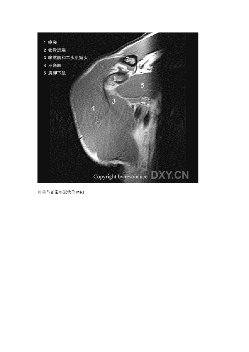 肩关节正常MRI解剖图谱_第2页