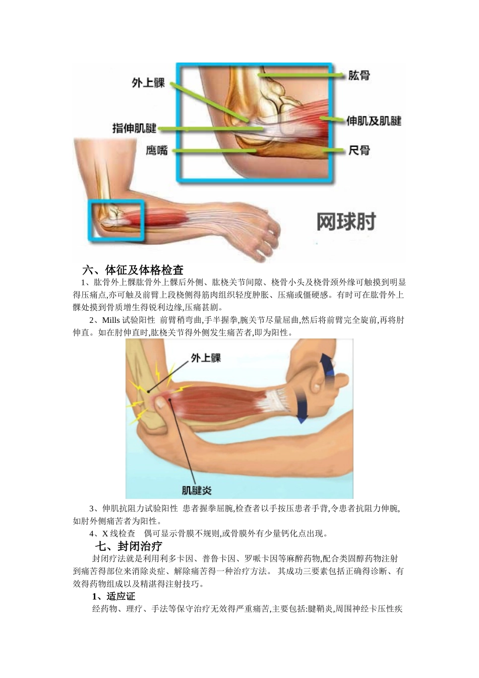 肱骨外上髁炎的封闭治疗_第3页