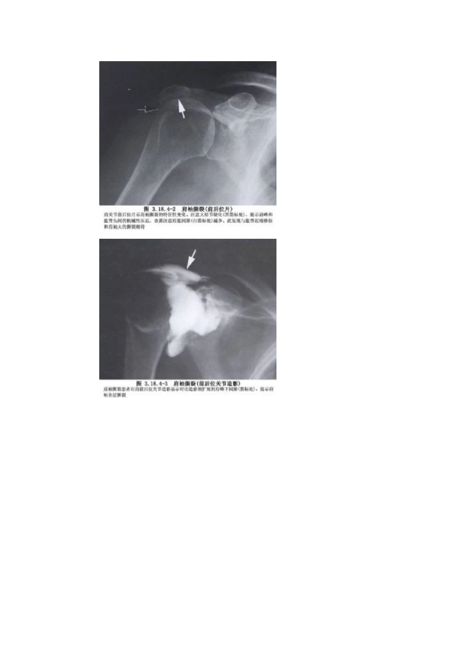 肩关节镜概述_第2页