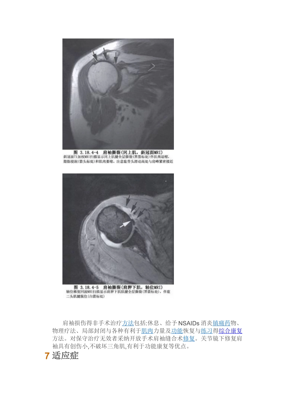 肩关节镜概述_第3页