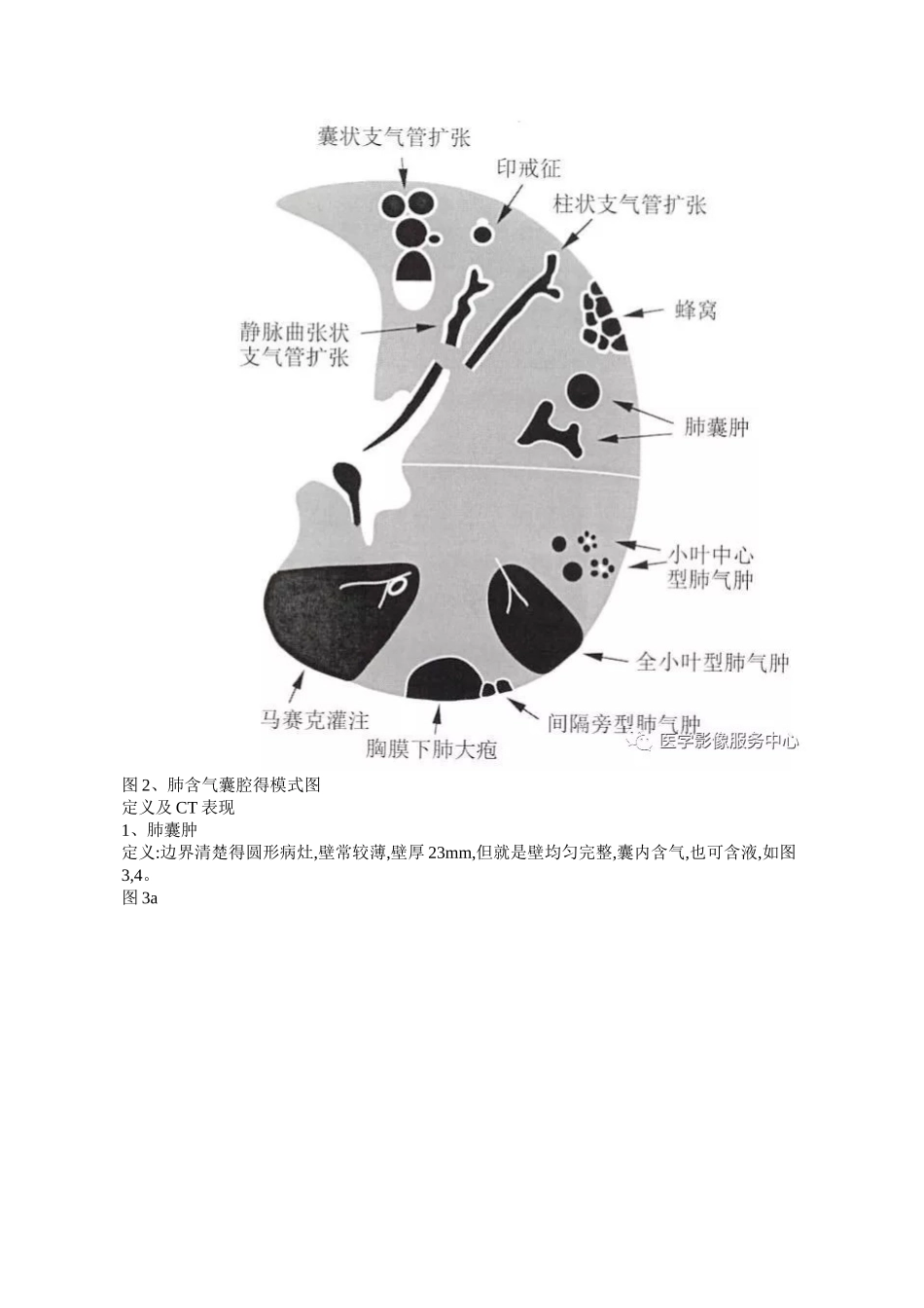 肺含气囊腔分类、定义及CT诊断_第2页