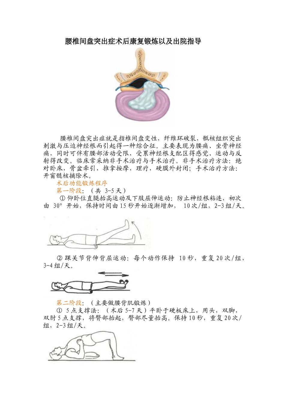 腰椎间盘突出症术后康复锻炼以及出院指导_第1页