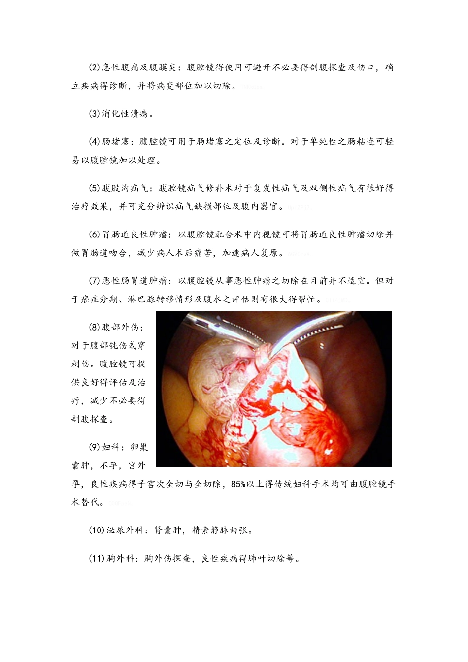 腹腔镜外科知识,适用于一般科普_第2页