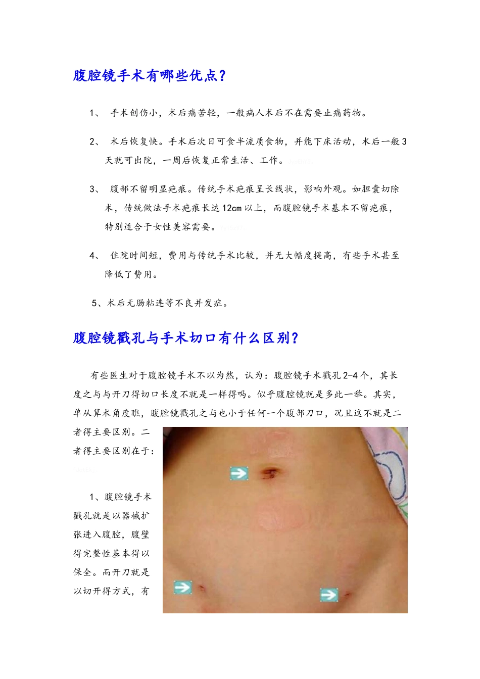腹腔镜外科知识,适用于一般科普_第3页