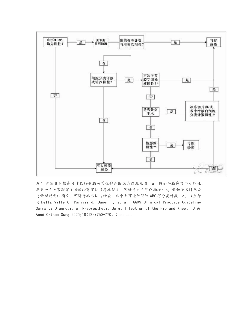 膝关节置换术后感染_第2页
