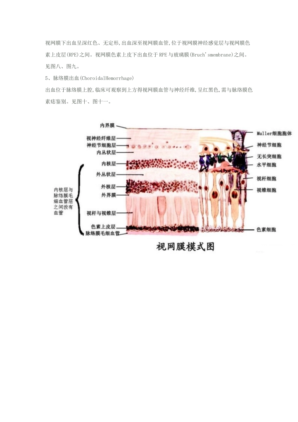 视网膜出血鉴别_第3页