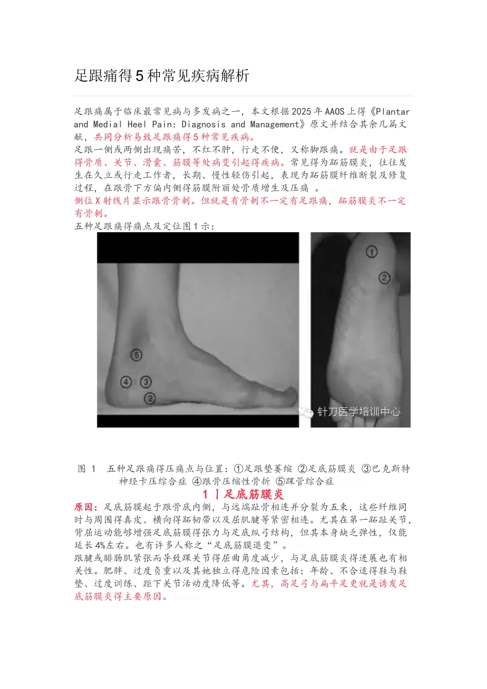 足跟痛的5种常见疾病解析_第1页