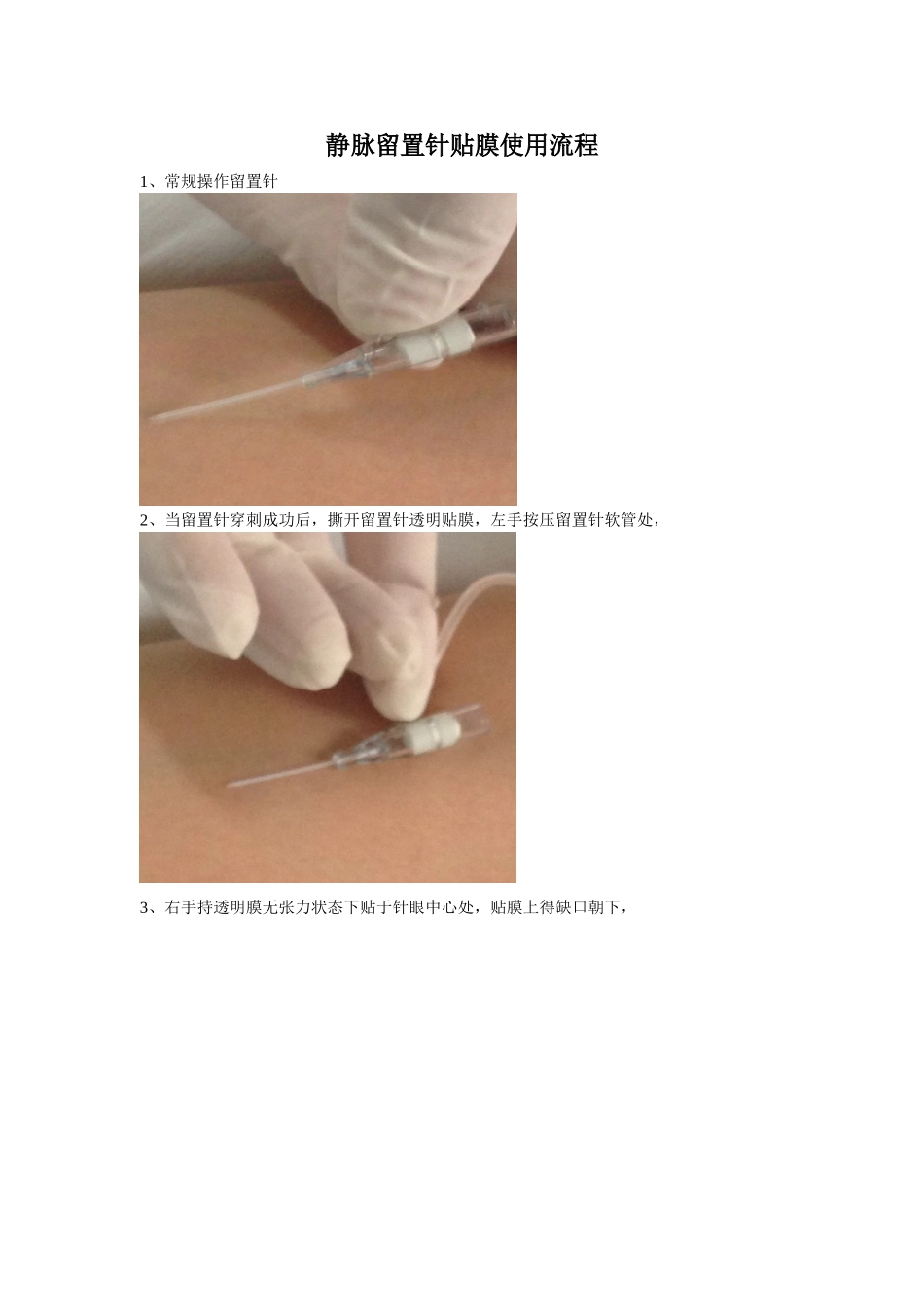 静脉留置针贴膜流程_第1页