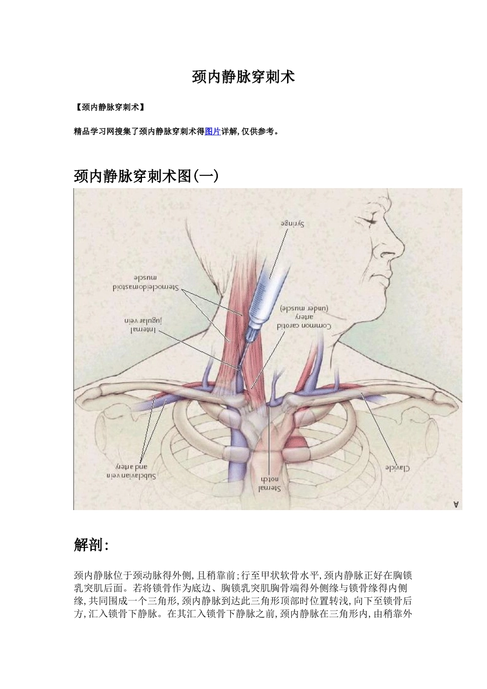 颈内静脉穿刺术_第1页