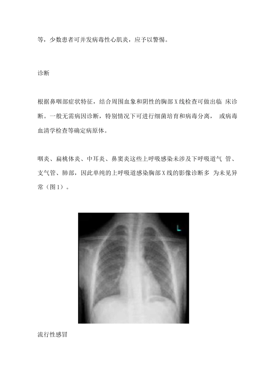 2025儿童或将面临新冠、流感鉴别诊断_第3页