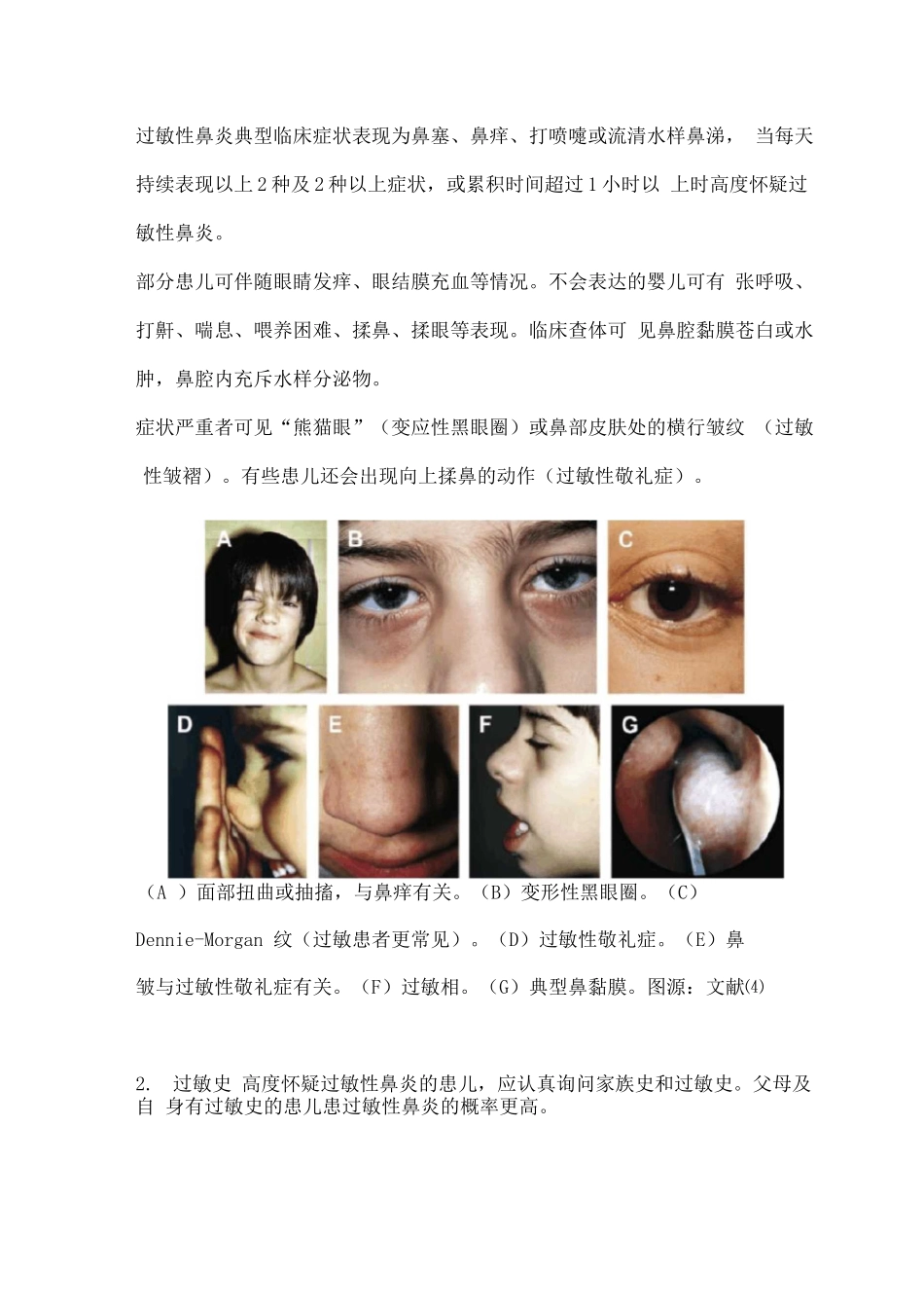 2025儿童过敏性鼻炎治疗_第2页