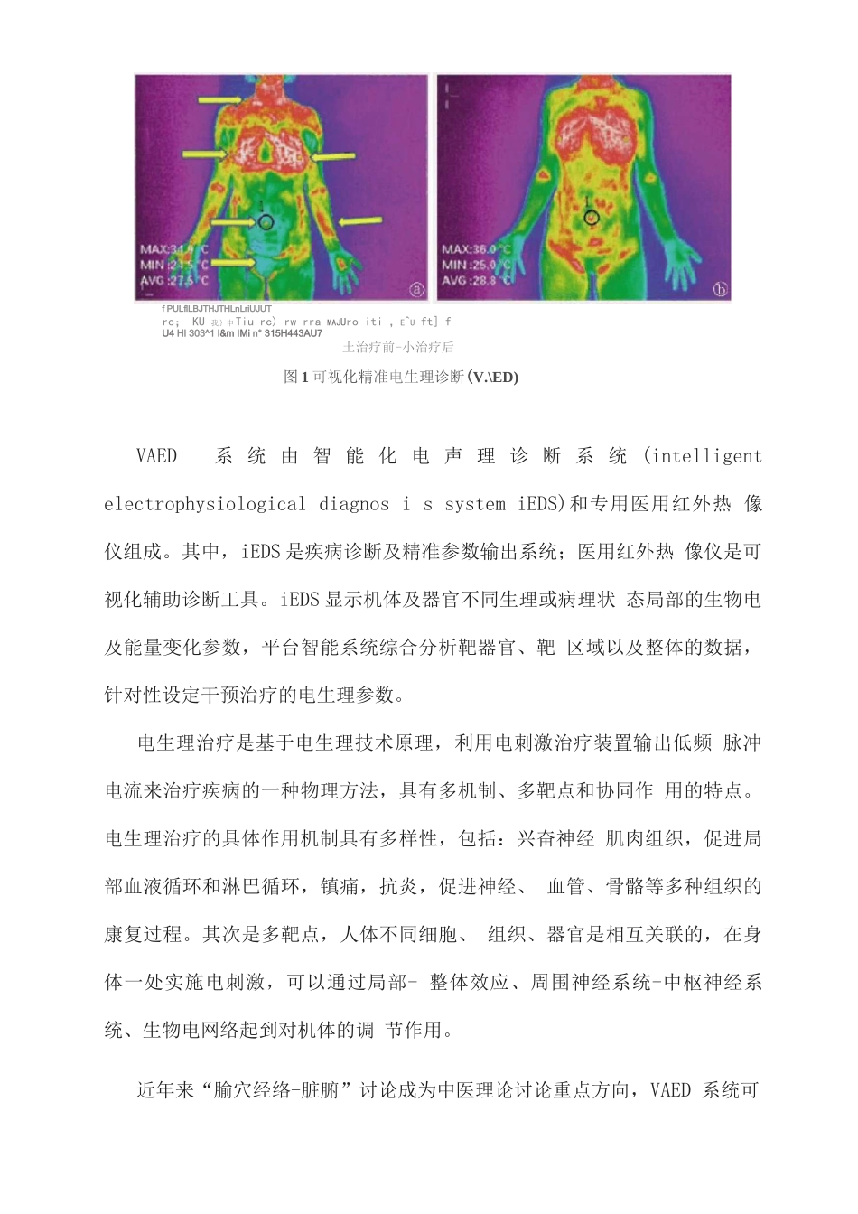 2025可视化精准电生理诊断在妇产科的应用2_第3页