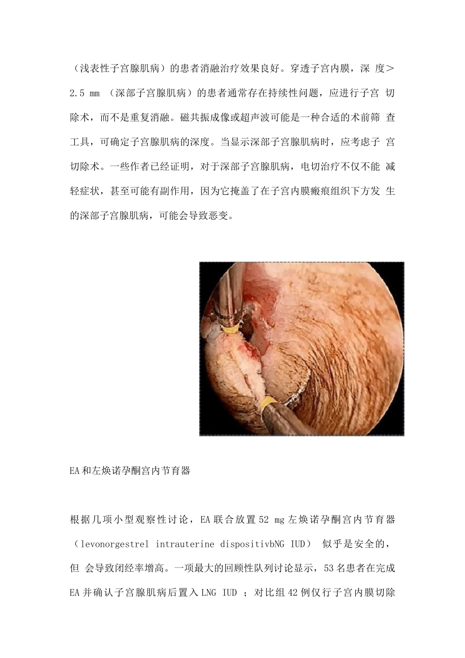 2025子宫腺肌病的子宫内膜消融术_第2页