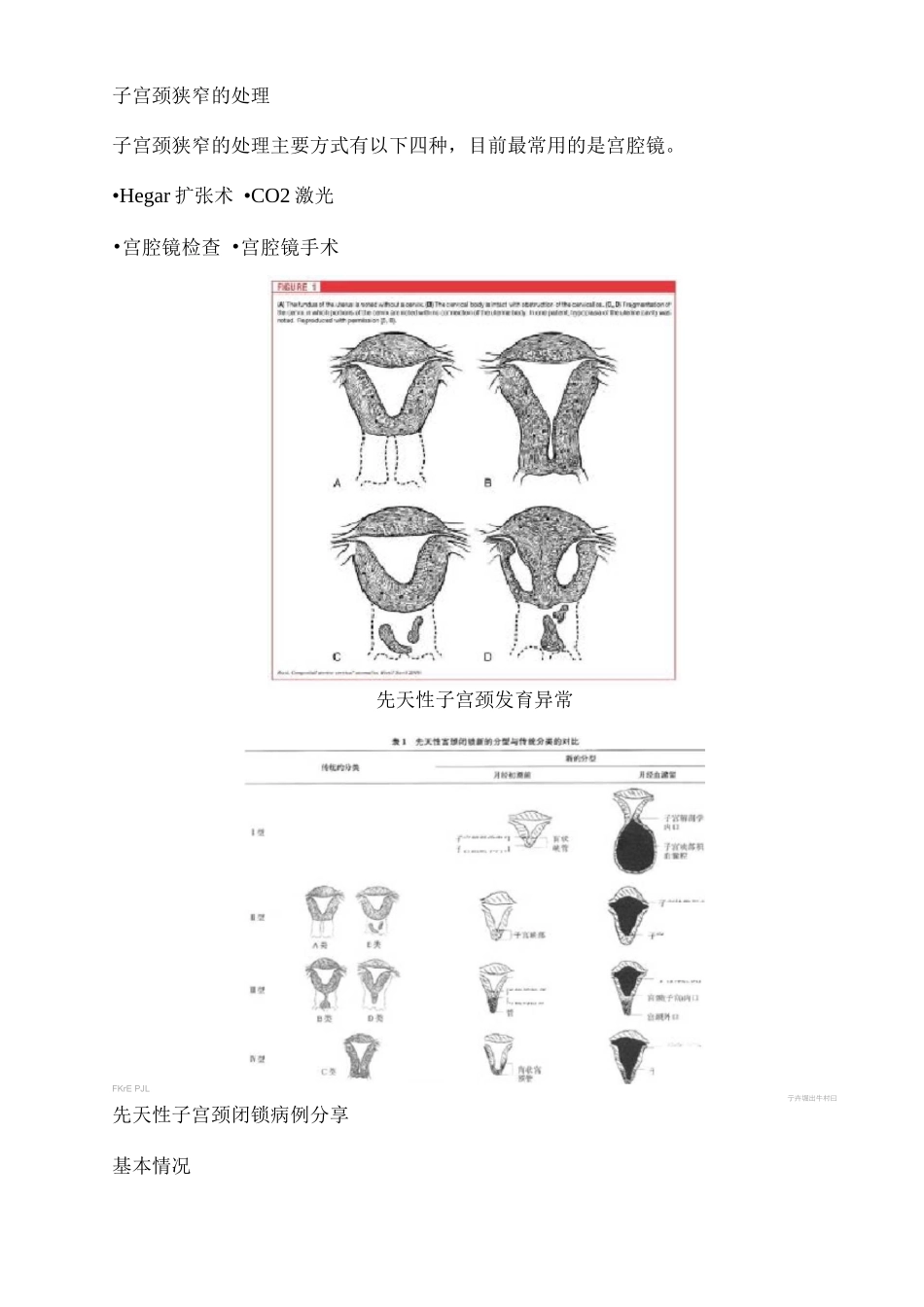 2025宫腔镜在子宫颈狭窄及粘连中的应用2_第2页