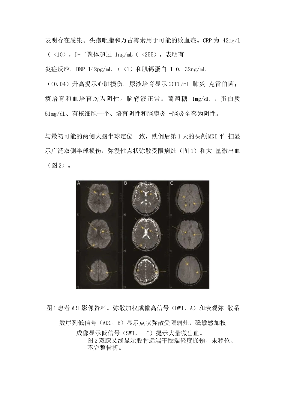 2025脊髓损伤患者跌倒后意识改变_第3页