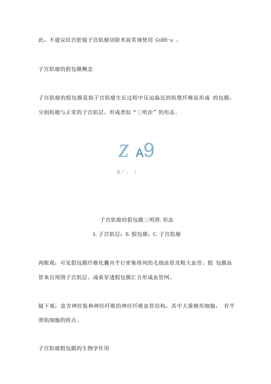 3型子宫肌瘤宫腔镜下切除_第3页