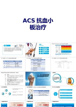 ACS抗血小板治疗讲义