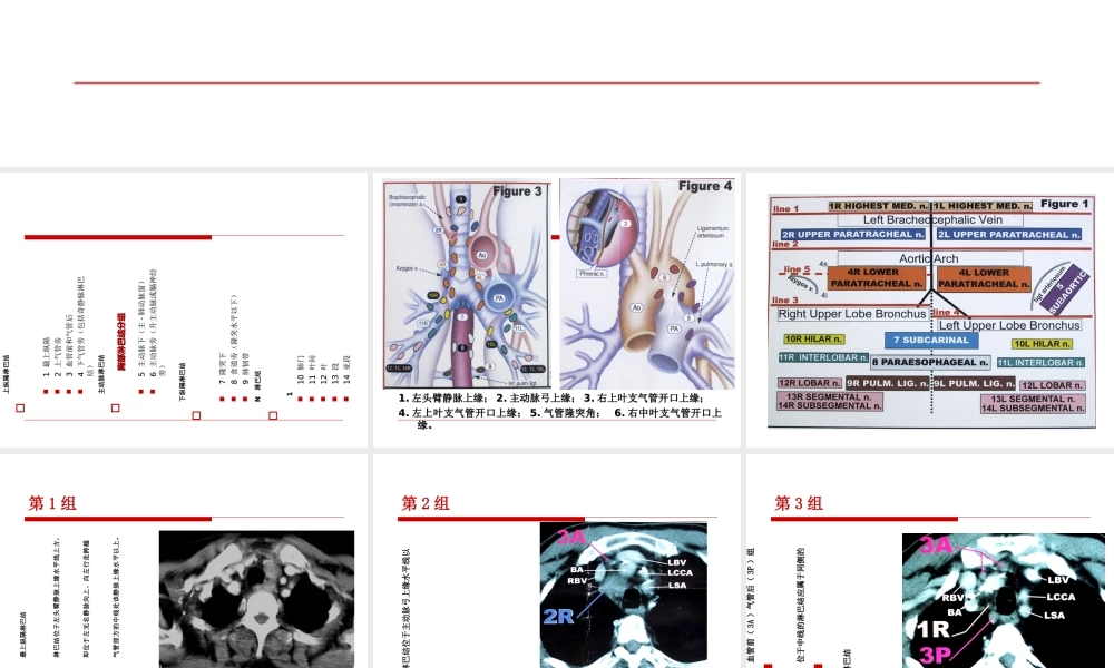 AJCC肺癌TNM分期-医学课件