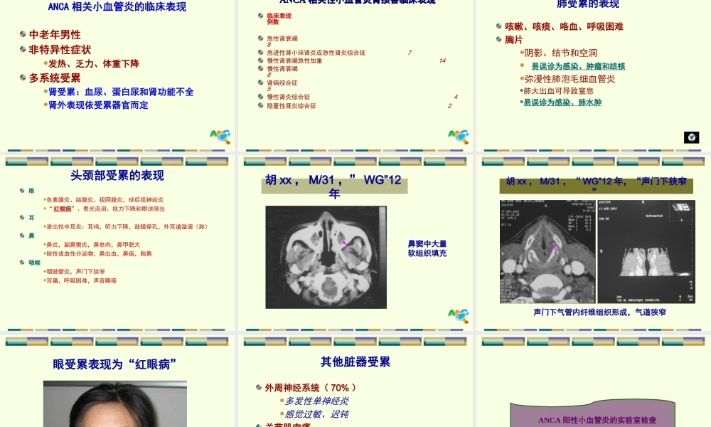 ANCA相关小血管炎优质PPT课件