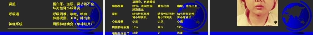 ANCA相关性血管炎重点资料优质PPT课件