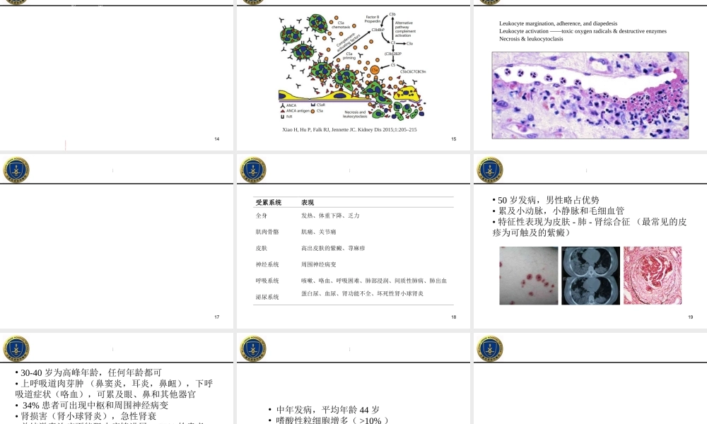 ANCA相关性血管炎专业资料医学资料优质PPT课件