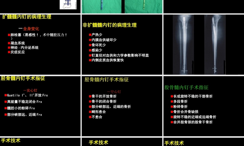AO髓内钉固定技术-医学课件
