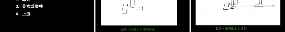 AO髓内钉固定技术-医学课件