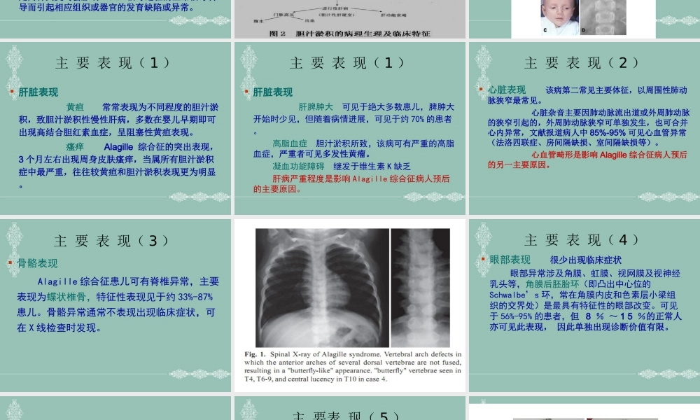 A综合征医学优质PPT课件